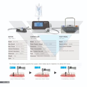 موتورایمپلنت